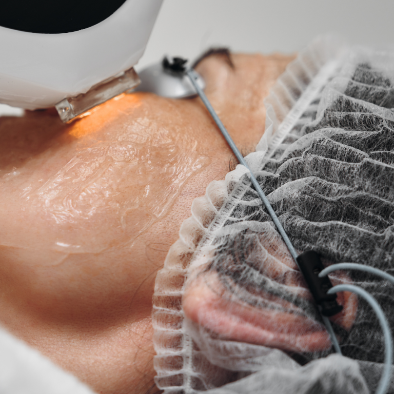 Pretty Woman Laser and Skin Clinic IPL Featured
